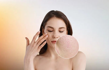5-Solutions-on-Dry-skin-with-open-Pores