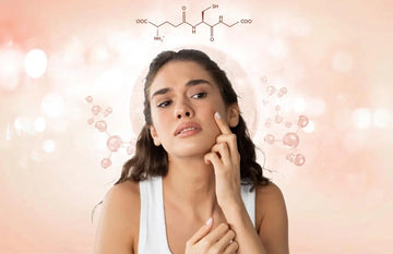 Glutathione for Acne: Does Glutathione Reduce Acne?