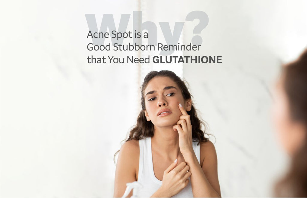 Why Acne Spot is a Good Stubborn Reminder that You Need Glutathione