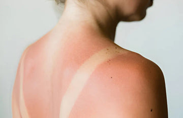 Can Glutathione Remove Tan?