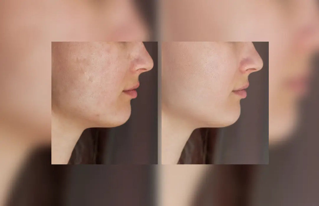glutathione after and before Glutathione Tablets Before and After: Results to Expect