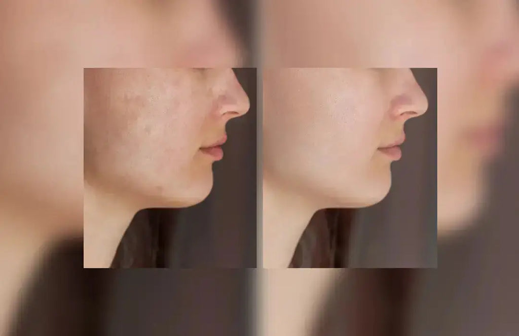 toniq glutathione before and after Tablets After: Results to Expect Dr. Greg Jones, NMD, cosmetic manufacturing PRICE:1TUBE