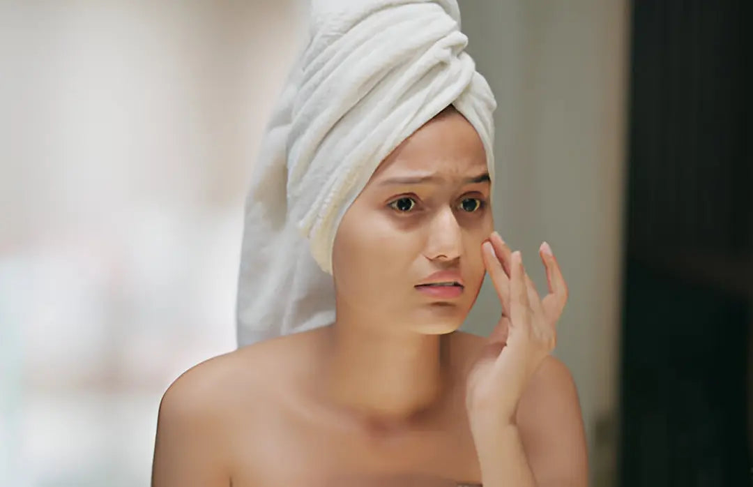 What Is Sensitive Skin Type what-is-sensitive-skin-type